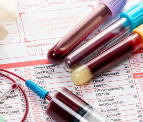 Все, что нужно знать об анализах крови